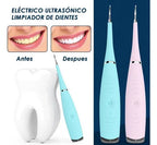 🦷 Cepillo Quita Sarro Eléctrico - Limpieza Dental Profesional en Casa